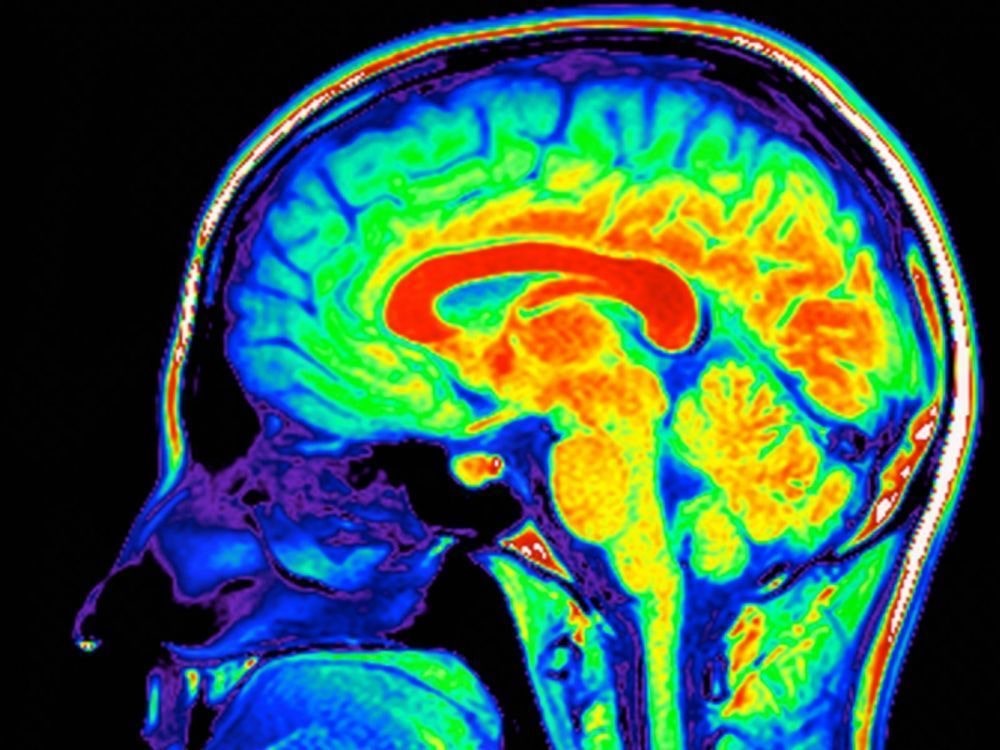 PetScan cerveau actif